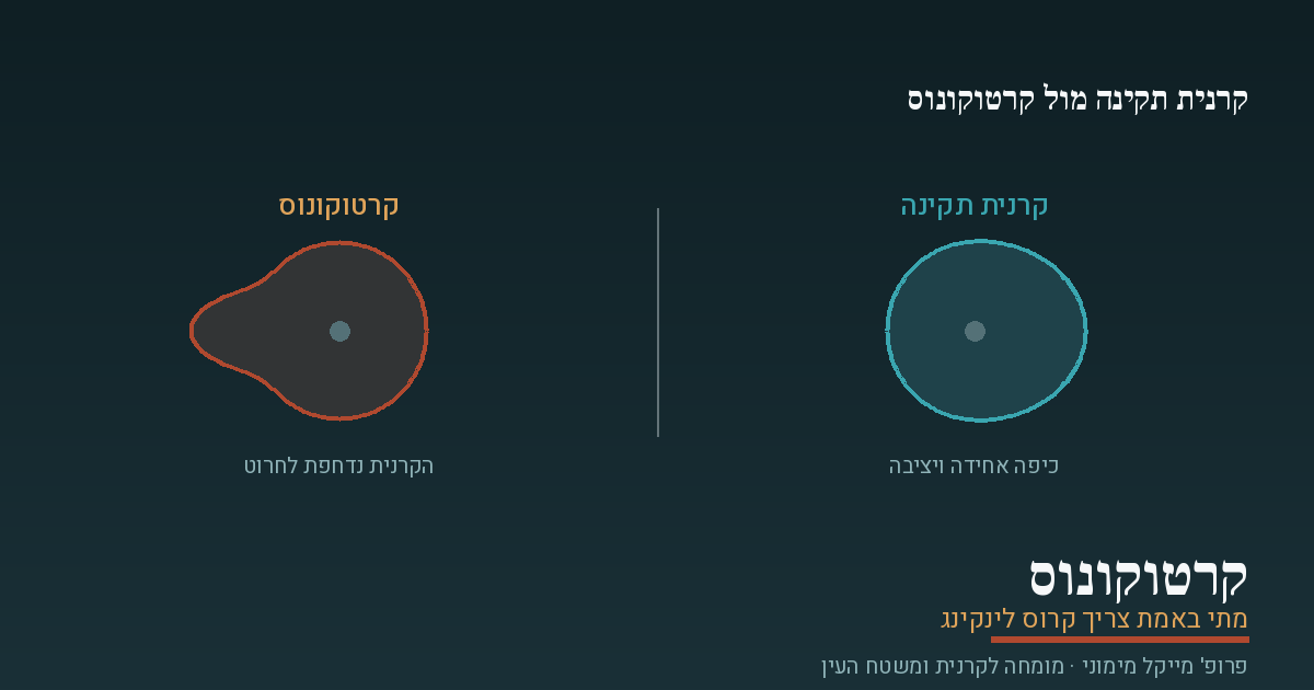 קרטוקונוס וקרוס לינקינג